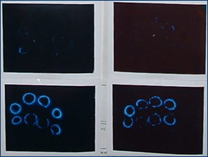 Kirlian Aura Before and After Ankh
